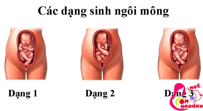 Tổng hợp những kiểu ngôi thai, vị trí thai nhi khác nhau